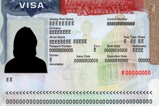 B62AEAB9-C19F-4544-A44B-8319605A9E17