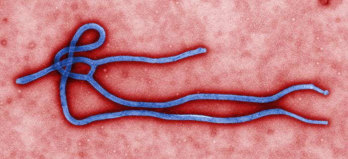 Colourised electron micrograph of an Ebola virus particle, used as a scientific illustration