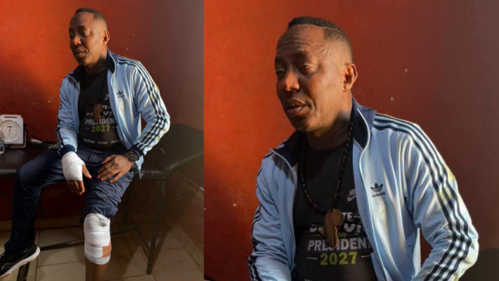 Omoyele Sowore seated with bandages on his wrist and knee in a composite photograph carried with the 30 October Ekiti incident report.